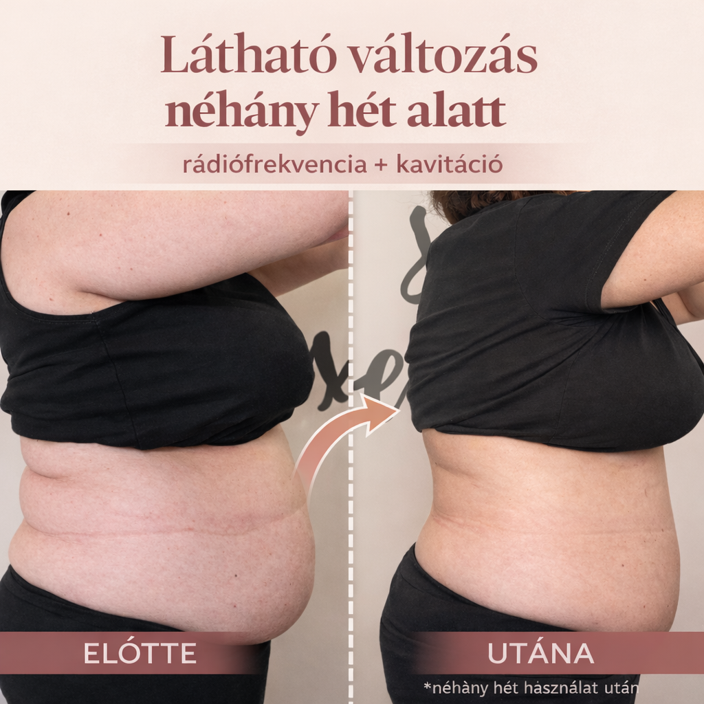 otthoni kavitációs kezelések